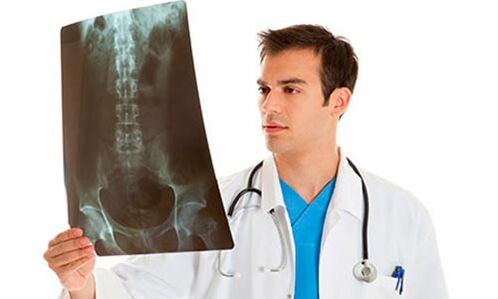 el médico mira una radiografía para diagnosticar el dolor lumbar
